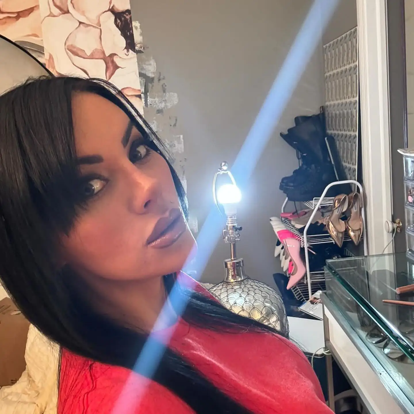 Fox Eyes Treatment - Before and After Image 8